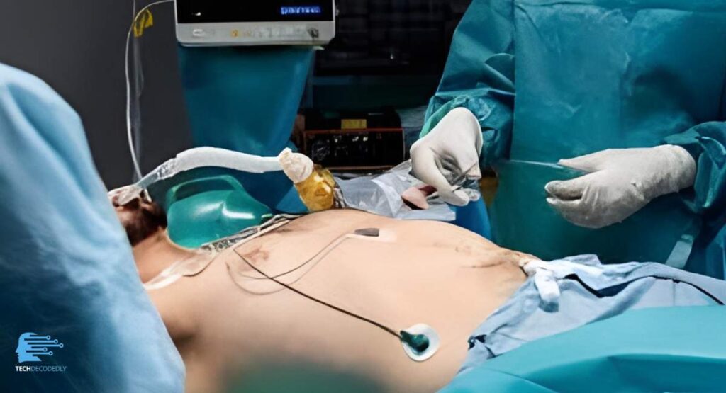 Why Patients Need Gallbladder Surgery TechDecodedly